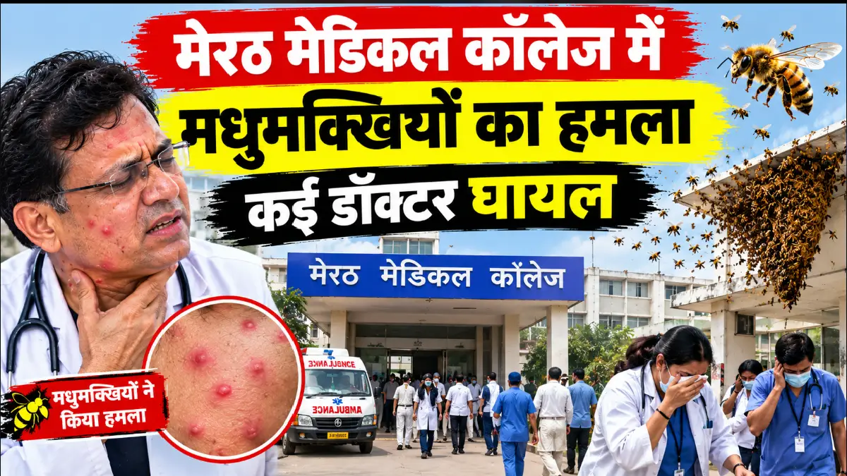 मेरठ मेडिकल कॉलेज में मधुमक्खियों का हमला: डॉ. दिनेश राणा को 300 डंक मारे, कई डॉक्टर घायल
